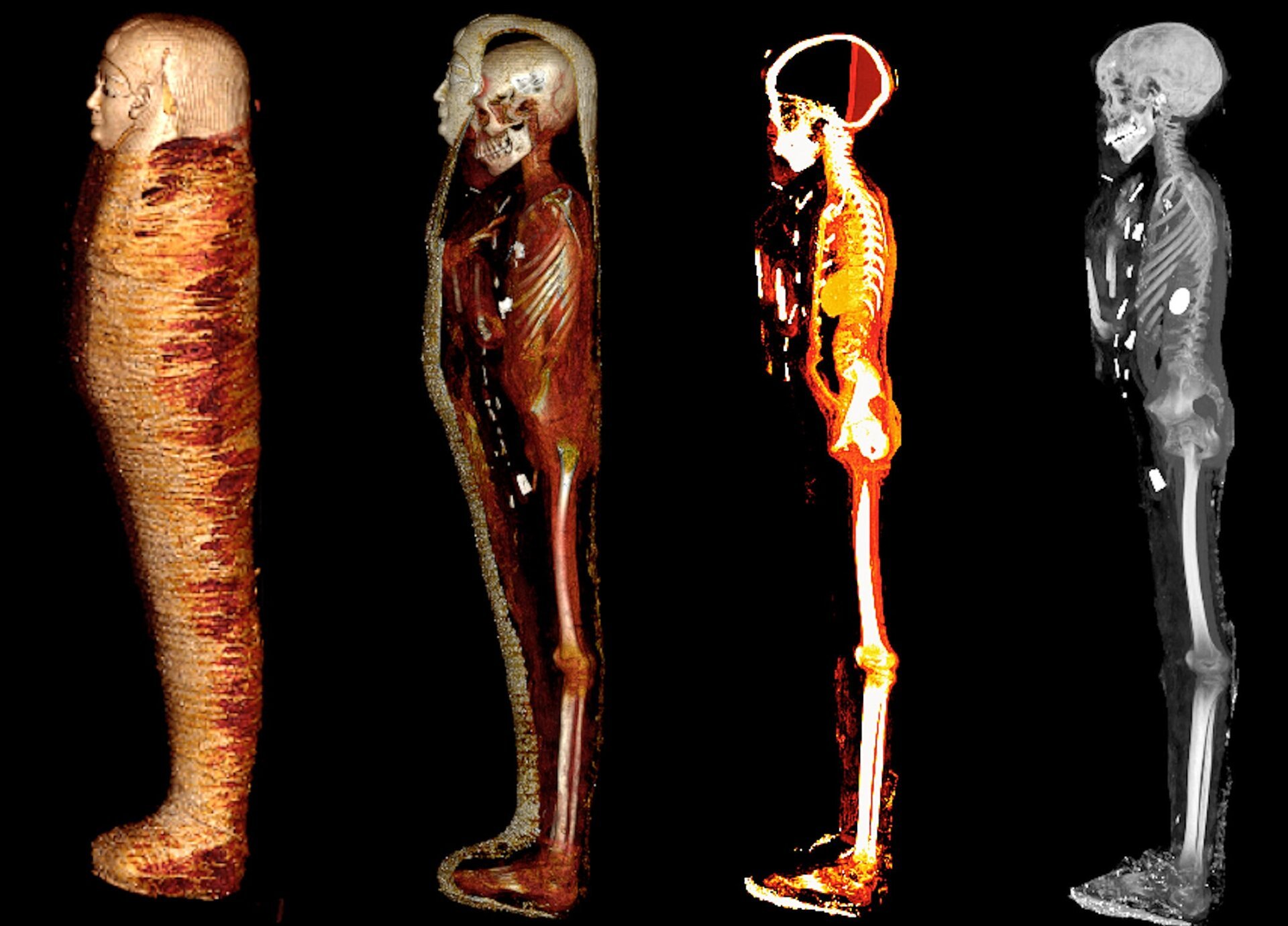 Unwrapping the Secrets of a 2,300-Year-Old Golden Boy Mummy