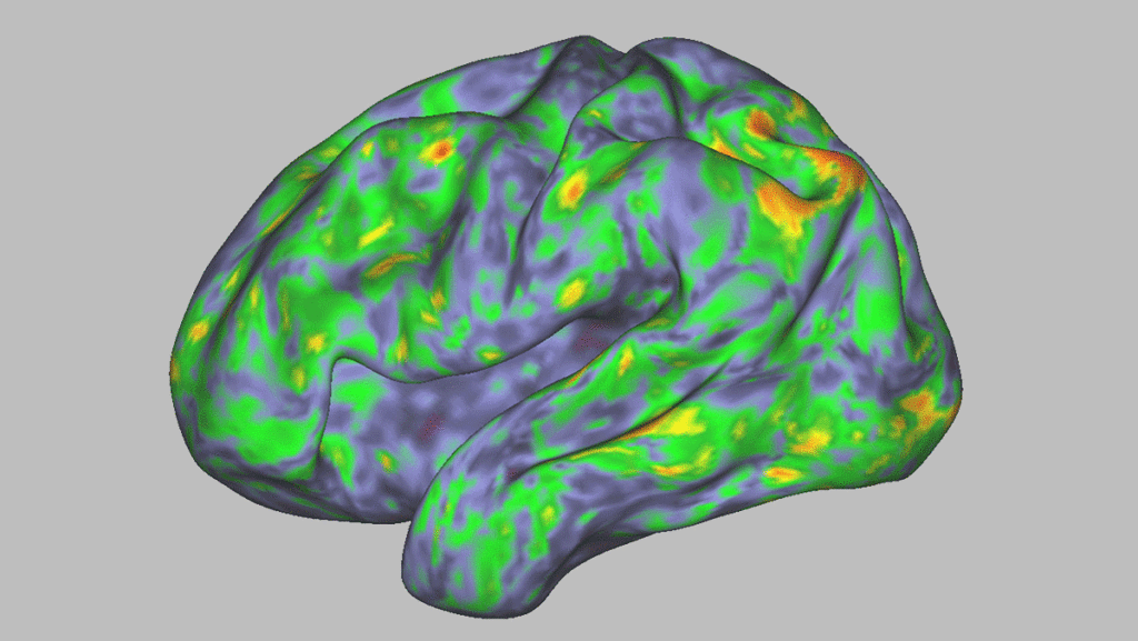 How Psilocybin Reshapes the Brain: A Glimpse into Psychedelic Therapy