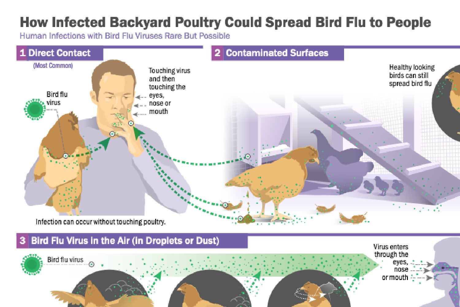 First Severe H5N1 Bird Flu Case Confirmed in the US, CDC Reports