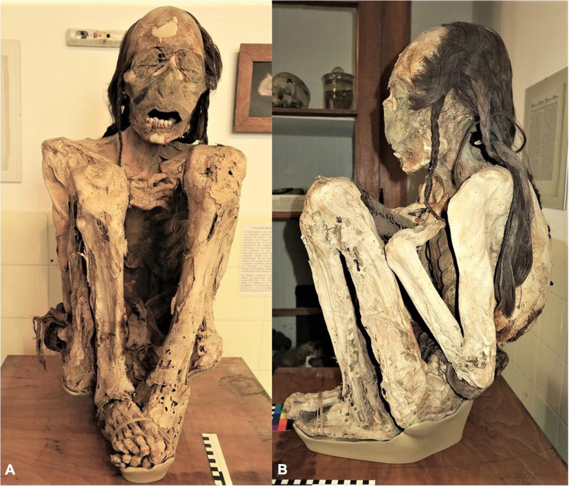 The “Marburg mummy,” buried in a position similar to many mummies from the area.