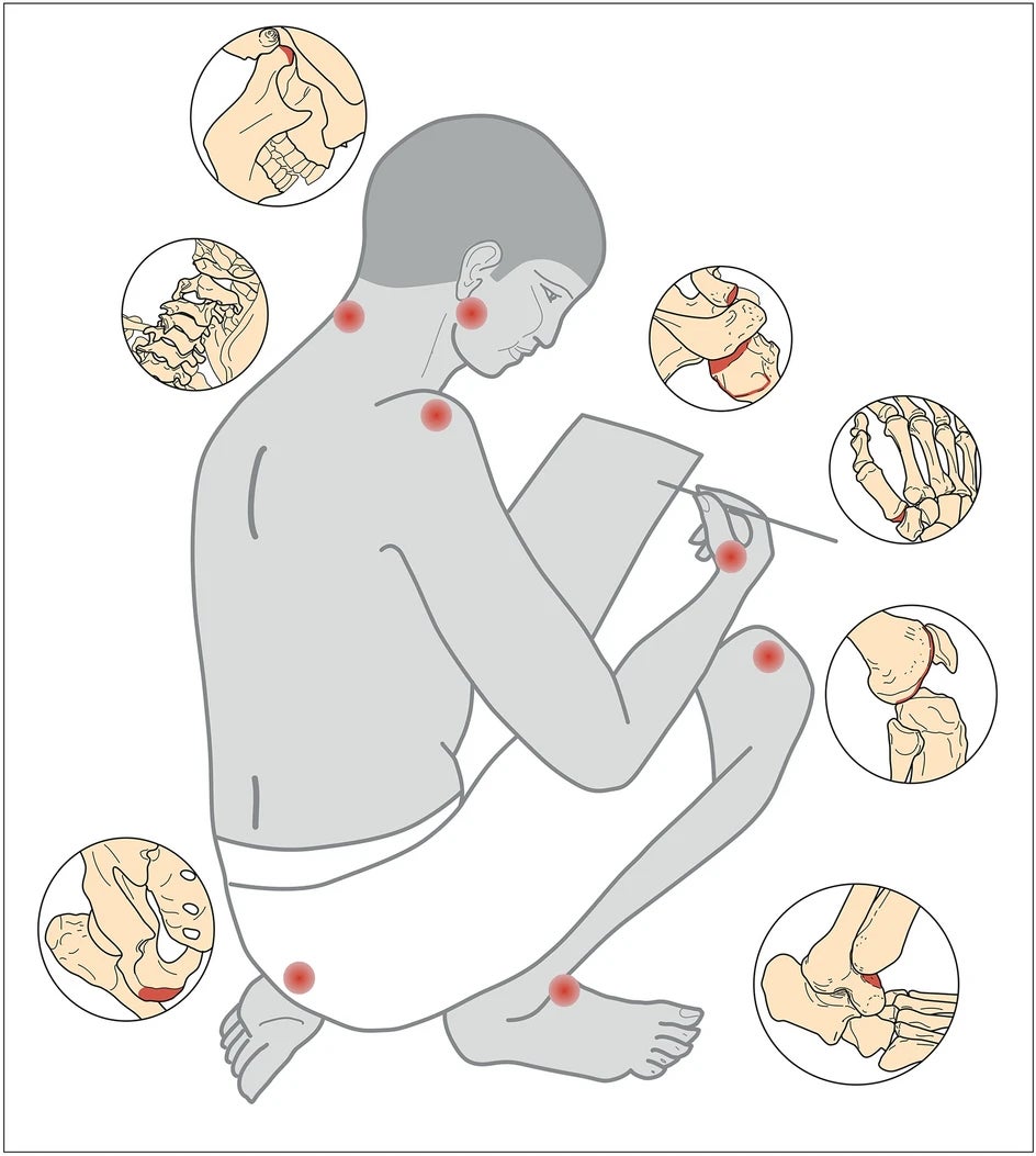 The working position of the scribe would affect their jaw, upper spine, lower back, shoulder, and joints.