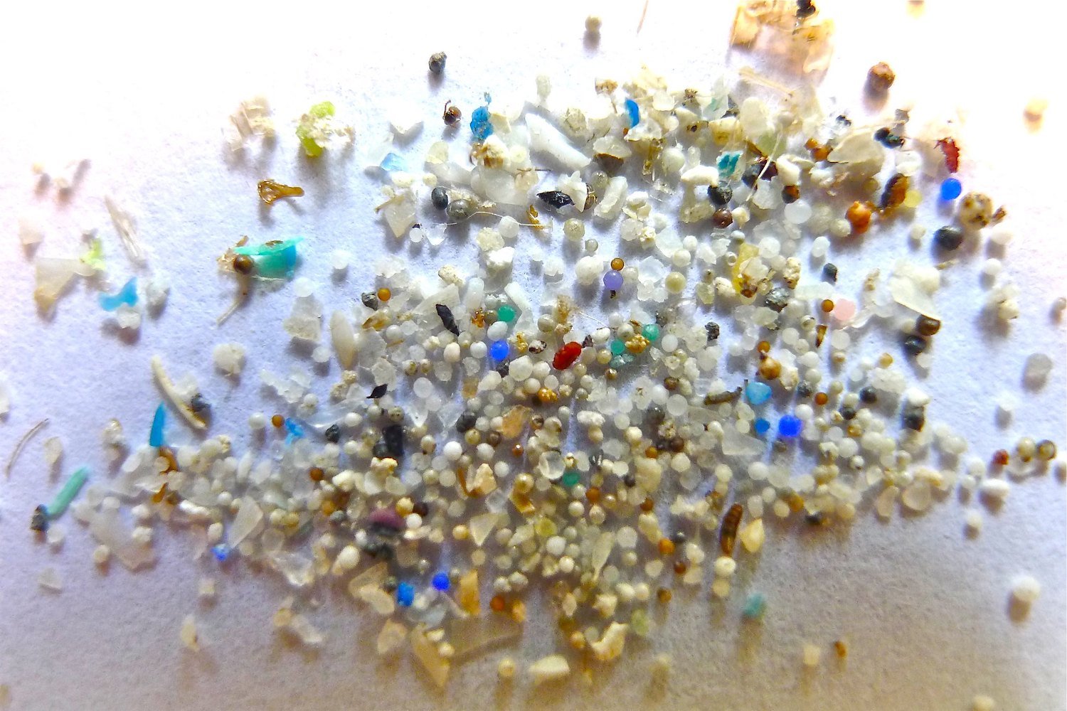 Microplastics Found Accumulating in Human Brains: A Growing Concern