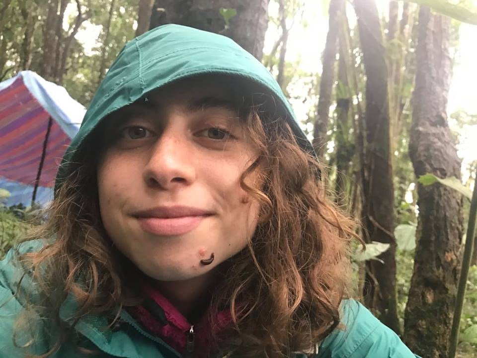 Researcher Mai Fahmy with a leech on her face, demonstrating how leeches often land on hosts from above.