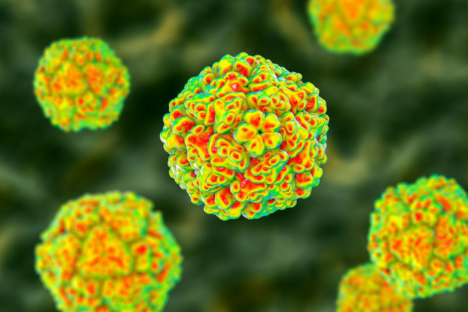 Enterovirus D68 Detected in US Wastewater, Raising Concerns About Potential AFM Cases