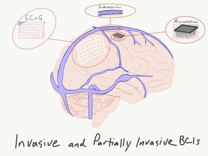 Examples of invasive and partially invasive EEGs