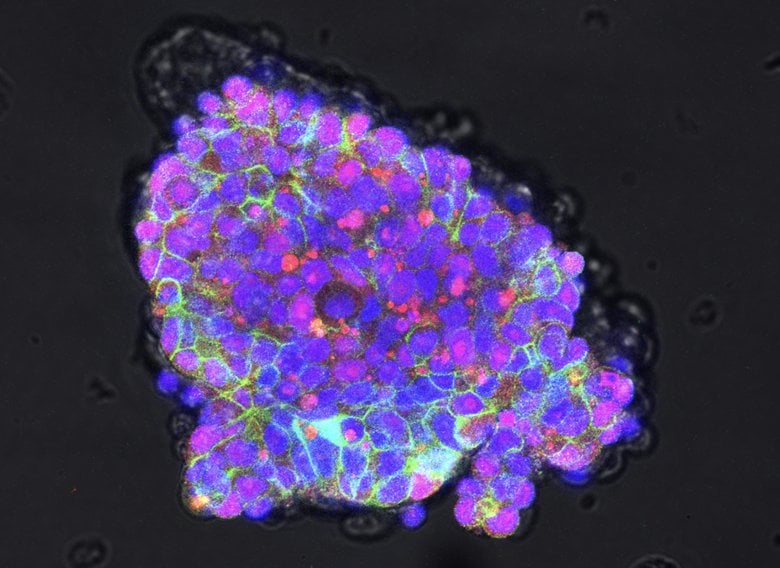 A colony of fat-tailed dunnart stem cells. 