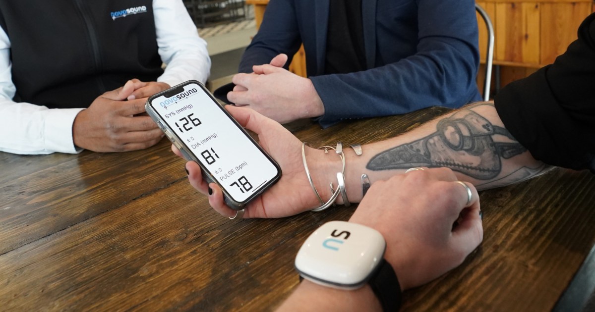 Revolutionizing Real-Time Blood Pressure Monitoring with Wearable Ultrasound