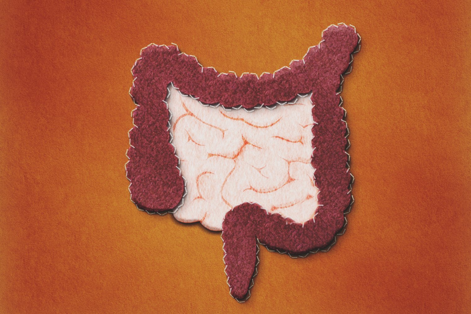 Fecal Transplants Show Promise for Type 1 Diabetes Gut Issues