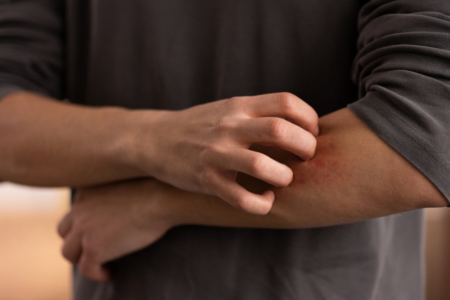 Why Scratching an Itch Makes It Worse (But Feels So Good)