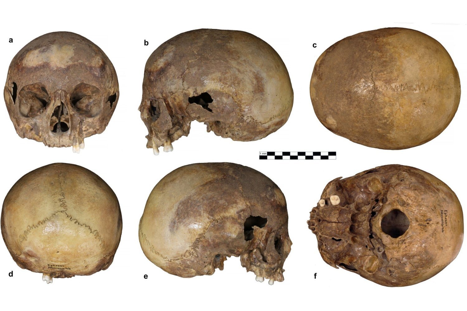 Ephesus Skeleton: Not Cleopatra's Sister, But a Young Boy