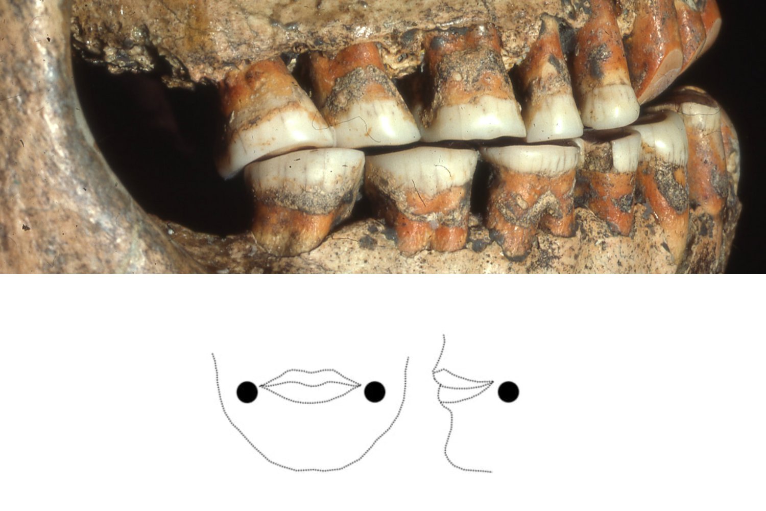 Did Ice Age Europeans Sport Cheek Piercings?