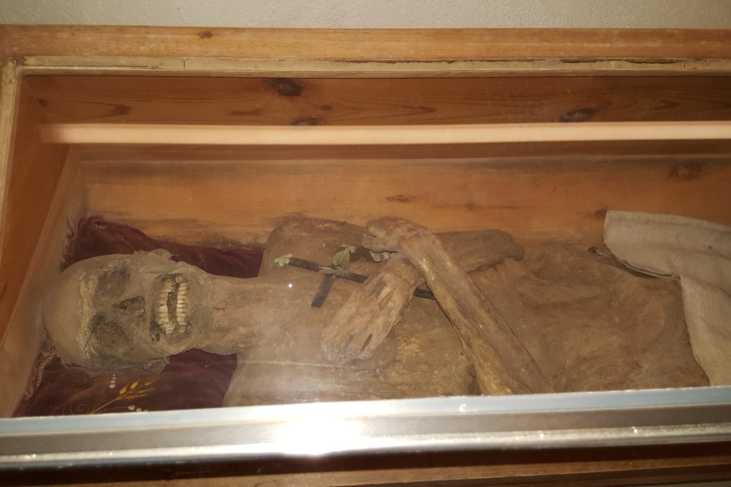 18th-Century Austrian Mummy Reveals Unique Anal Embalming Method