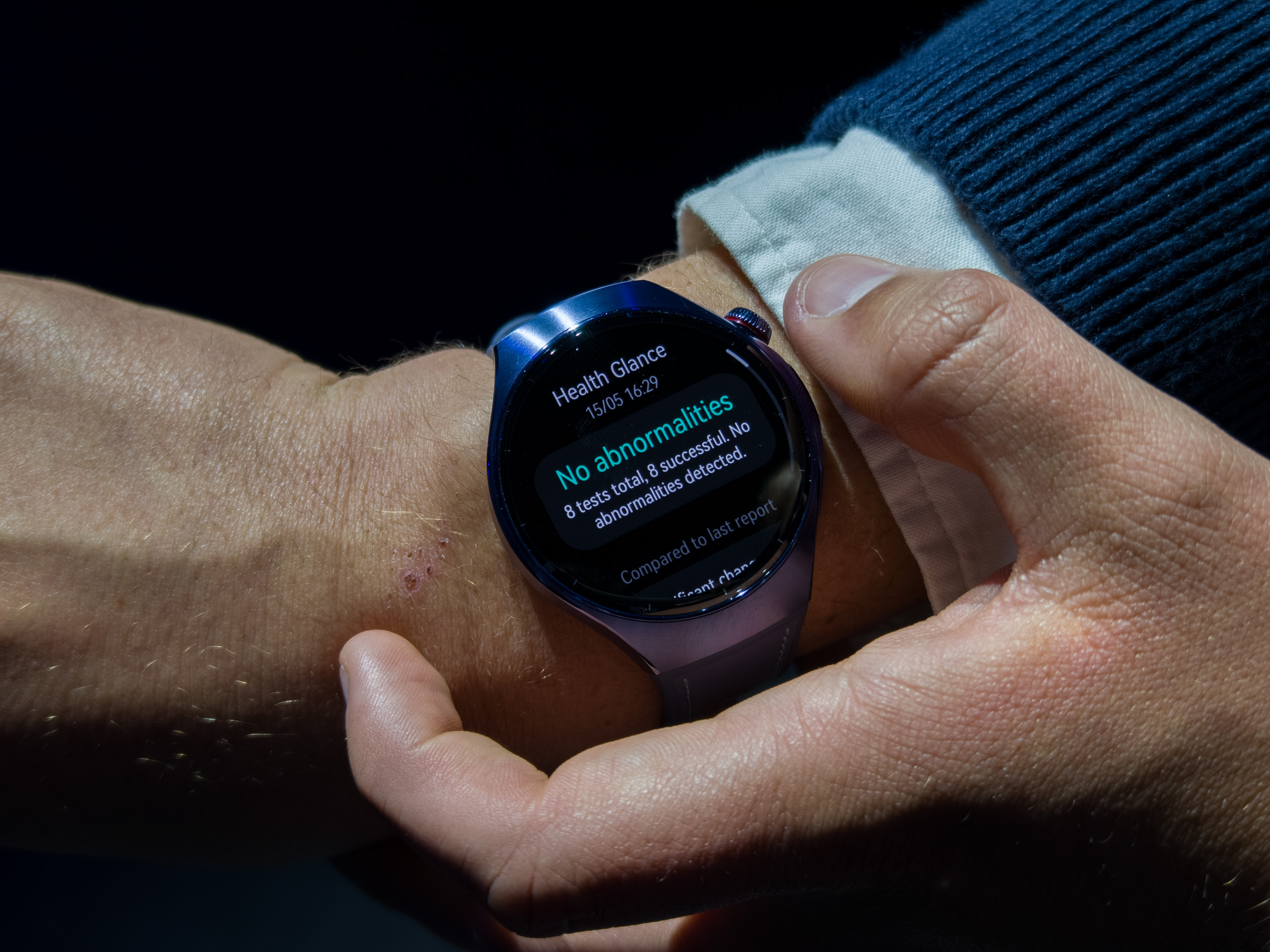 Alt:  Results displayed after completing the 60-second health check on the Huawei Watch 5.