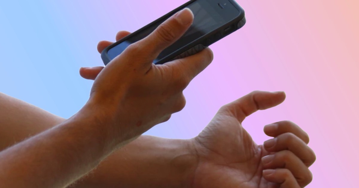 Anemia Detection: Revolutionizing Screening with AI-Powered Nail Selfies