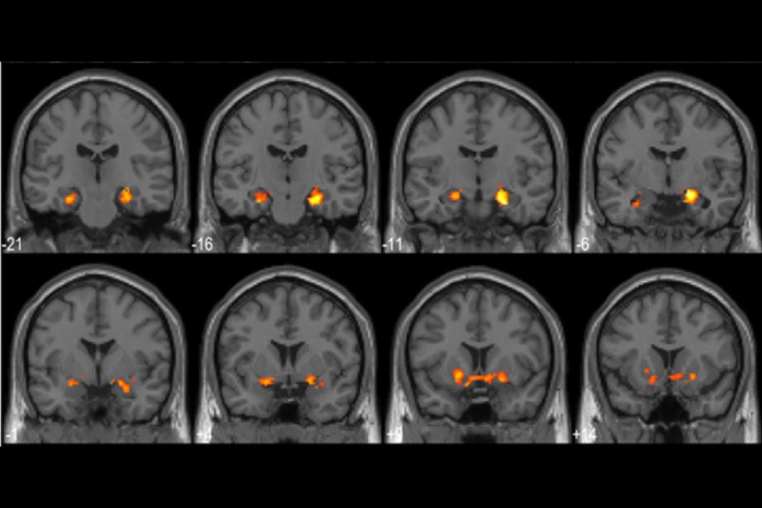 The Neuroscience of "Aha!" Moments: How Epiphanies Boost Memory
