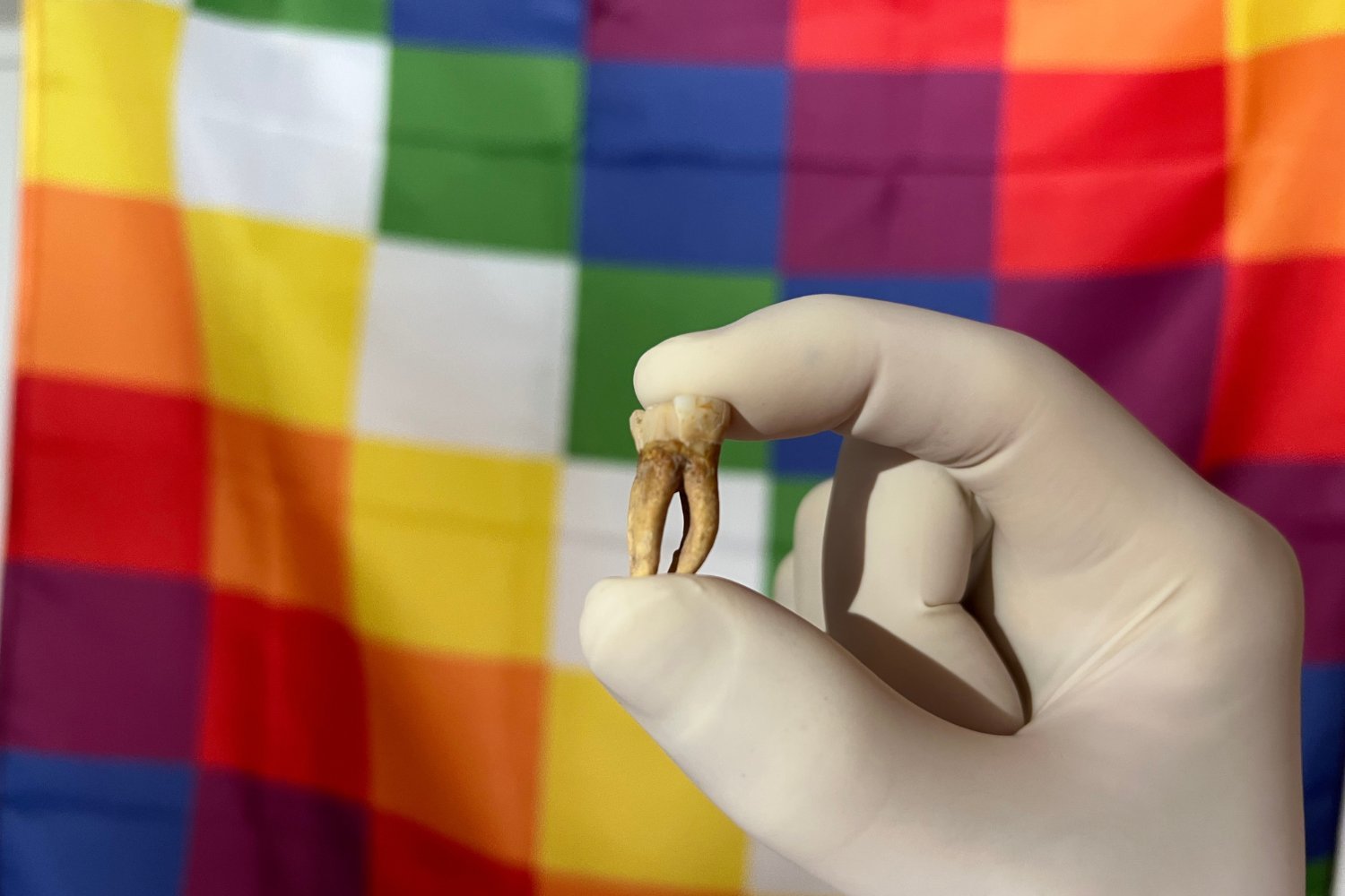 Ancient Leprosy in the Americas: A Surprising Pre-European Origin Story
