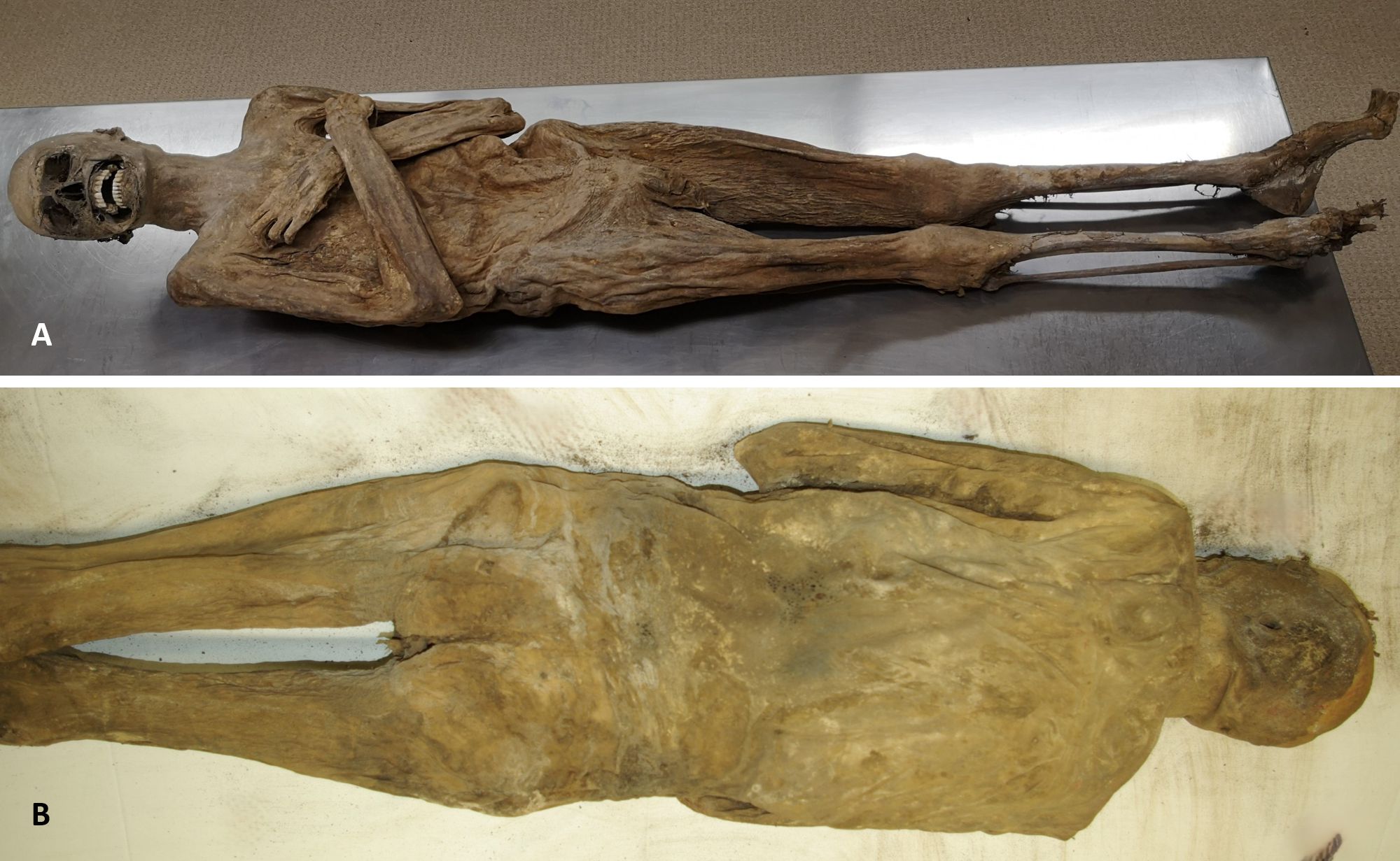 Full Body Mummy