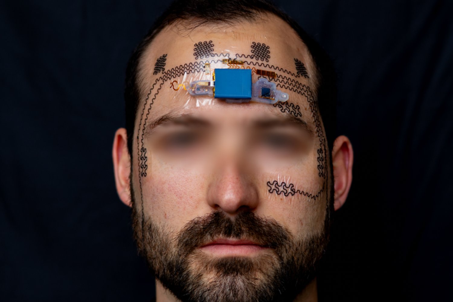 E-Tattoo Breakthrough: Monitoring Stress Levels Through Your Forehead