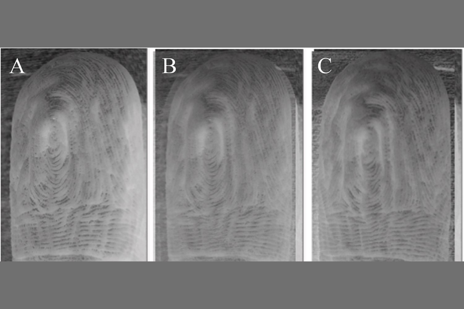 The Science Behind Pruney Fingers: Consistent Wrinkle Patterns Revealed
