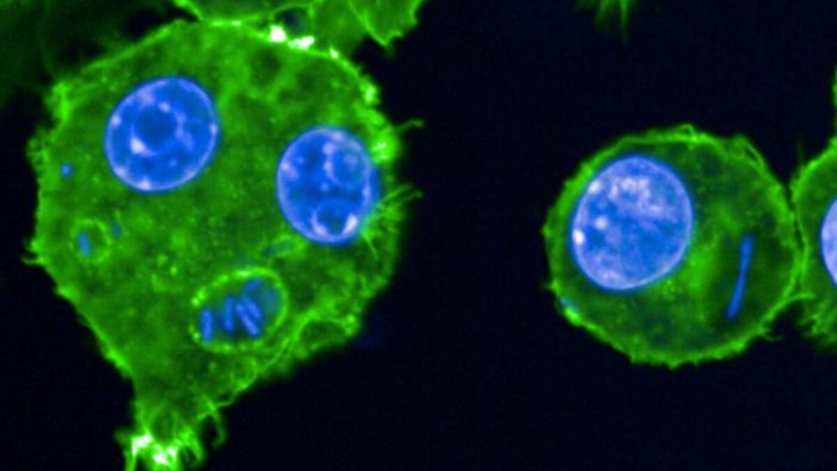 Genetic Shift in Plague Bacterium May Have Lengthened Pandemics